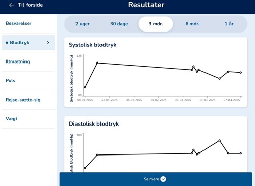 Billede af grafisk måling i Telma-programmet
